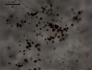 Hyphae and spores of Rhizophagus irregularis in a root organ culture